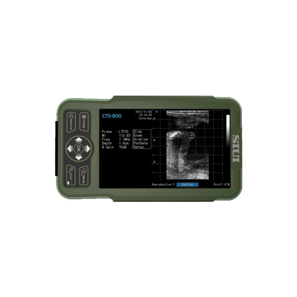 ReproMax – Ultrasonido Siui CTS-800 104